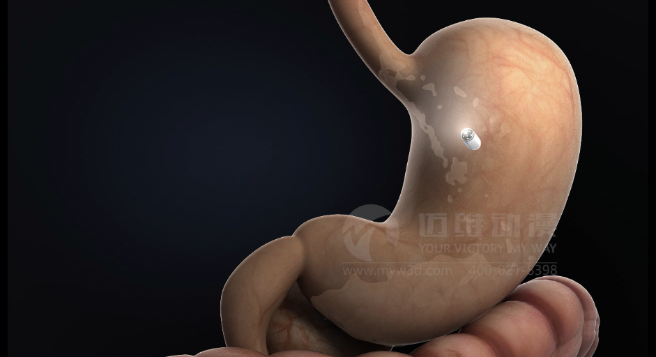 醫學醫療三維動畫