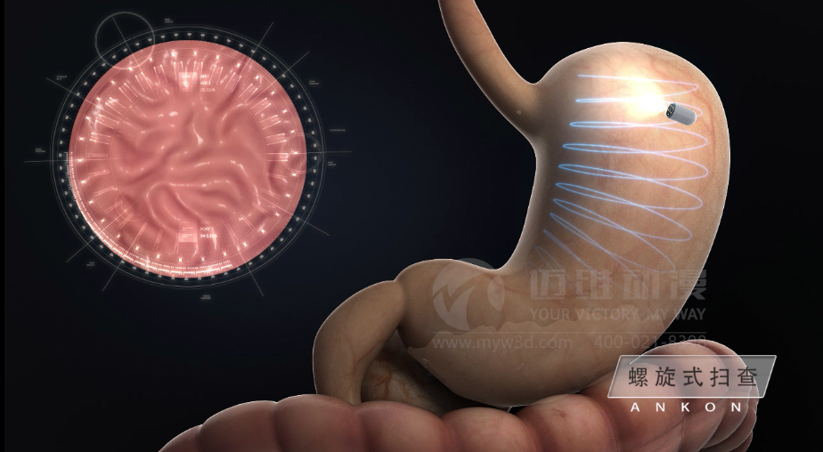 醫學醫療三維動畫