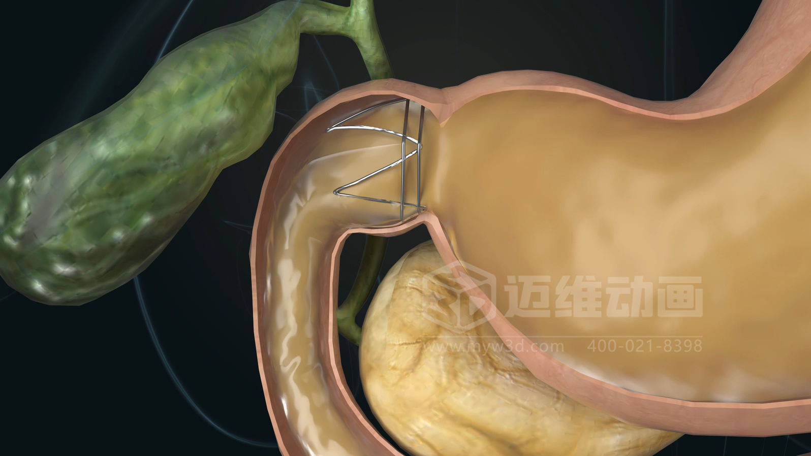醫學科普從來不是 “天書”:三維動畫讓復雜科學原理輕松 get!(圖12) 醫學科普從來不是 “天書”:三維動畫讓復雜科學原理輕松 get!(圖12)