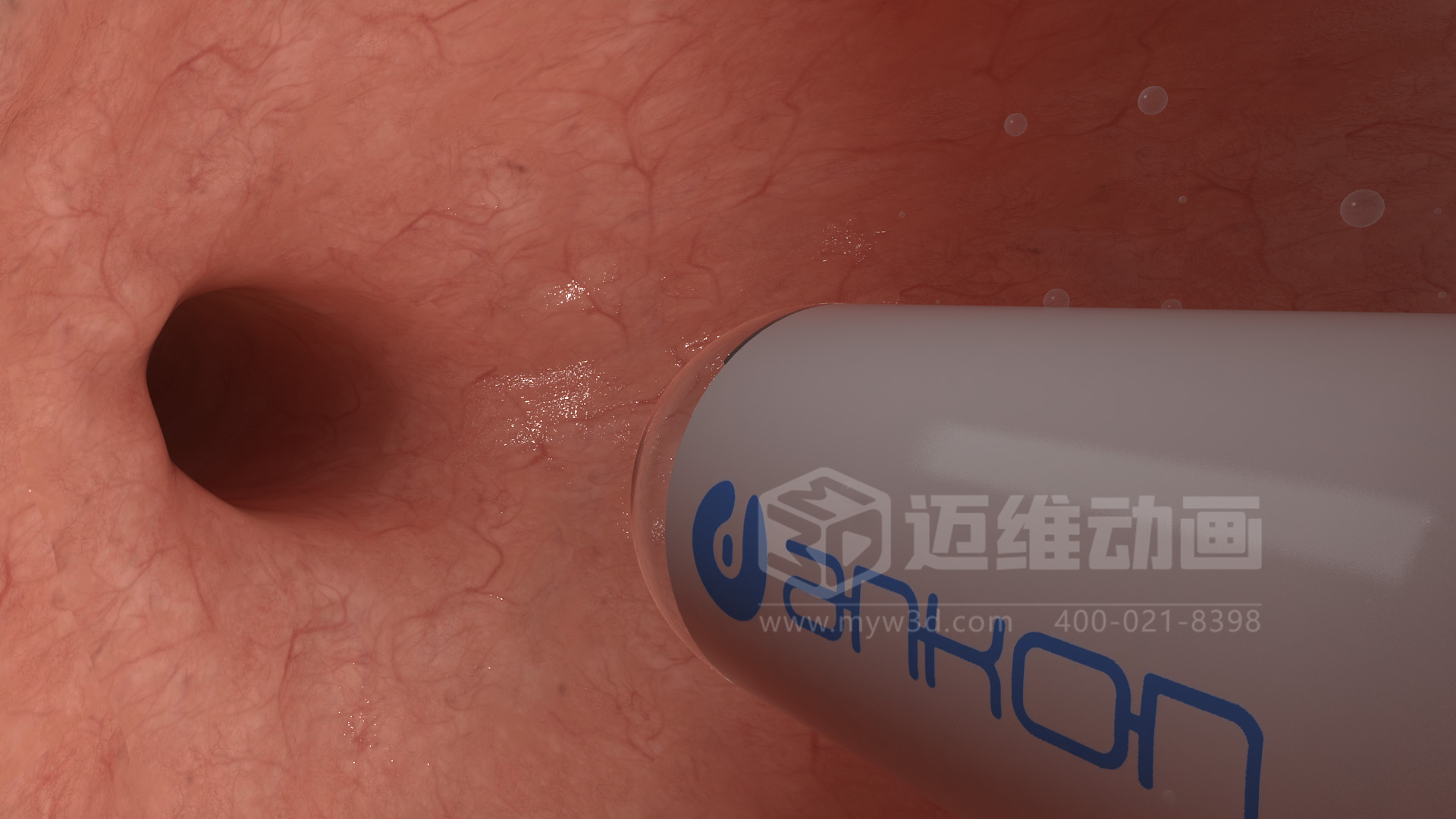 醫學檢測設備如何突破消化道檢查壁壘?三維動畫還原核心技術與臨床價值(圖4) 醫學檢測設備如何突破消化道檢查壁壘?三維動畫還原核心技術與臨床價值(圖4)